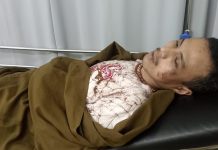 SUNGGUH KEJI DISEKAP DIGANTUNG DIPUKULI OLEH LIMA ORANG:Dua Warga Sukarasa Babak Belur Jadi Korban Penganiayaan Oknum Preman